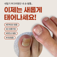 [등촌동] 김수정뷰티 가양역점 문제성 손/발톱 케어 체험단 모집
