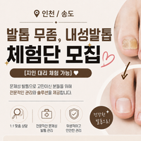 인천/송도 발톱 무좀, 문제성발톱 체험단 모집 [지인 대리 체험 가능]❤️